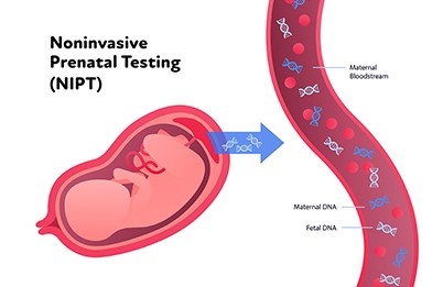 NIP-Test